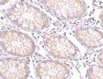 PTK7 Polyclonal Antibody