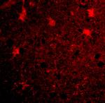 BRCC3 Polyclonal Antibody