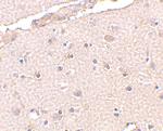 BRCC3 Antibody in Immunohistochemistry (IHC)