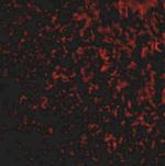 TEM7 Antibody in Immunohistochemistry (IHC)