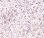 TEM7 Polyclonal Antibody
