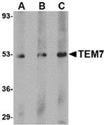 TEM7 Antibody in Western Blot (WB)