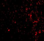 TEM7 Polyclonal Antibody