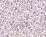 TEM7 Antibody in Immunohistochemistry (IHC)