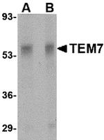 TEM7 Antibody in Western Blot (WB)