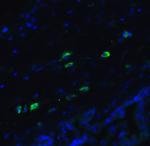 ARMET Antibody in Immunocytochemistry (ICC/IF)