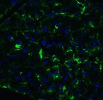 ARMET Polyclonal Antibody