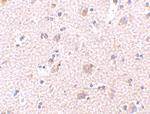 ARMET Polyclonal Antibody