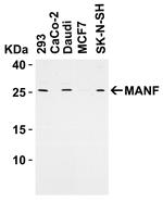 ARMET Antibody in Western Blot (WB)