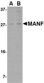 ARMET Antibody in Western Blot (WB)