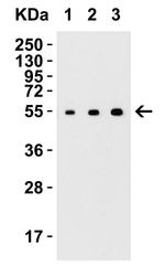 ARMET Antibody in Western Blot (WB)