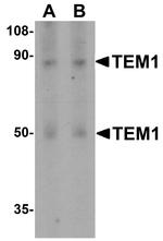 CD248 Antibody in Western Blot (WB)