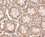 CD248 Polyclonal Antibody
