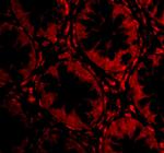 RASD2 Polyclonal Antibody