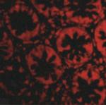 RASD2 Polyclonal Antibody