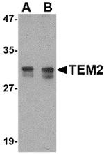 RASD2 Antibody in Western Blot (WB)