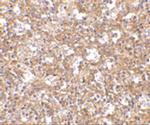 ARHGEF17 Polyclonal Antibody