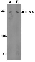 ARHGEF17 Antibody in Western Blot (WB)