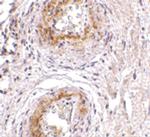 TEM5 Polyclonal Antibody