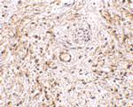 TEM5 Polyclonal Antibody
