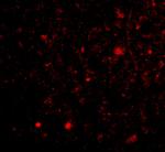 TOCA-1 Polyclonal Antibody