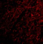 GRIK1 Polyclonal Antibody