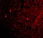 GRIK1 Polyclonal Antibody