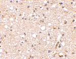 GRIK1 Antibody in Immunohistochemistry (IHC)