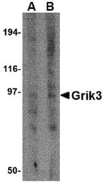 GluR7 Polyclonal Antibody