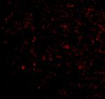 GRIK5 Polyclonal Antibody