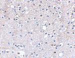 GRIK5 Antibody in Immunohistochemistry (IHC)