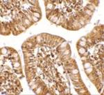 ZBP1 Polyclonal Antibody