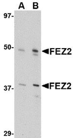 FEZ2 Antibody in Western Blot (WB)