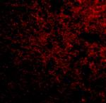 SP110 Polyclonal Antibody