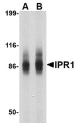 SP110 Polyclonal Antibody
