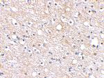 PLXDC2 Antibody in Immunohistochemistry (IHC)