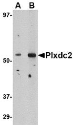 PLXDC2 Antibody in Western Blot (WB)