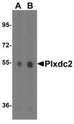 PLXDC2 Antibody in Western Blot (WB)
