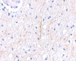 PLXDC2 Antibody in Immunohistochemistry (IHC)