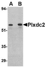PLXDC2 Antibody in Western Blot (WB)
