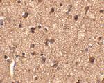SLITRK1 Antibody in Immunohistochemistry (IHC)