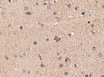 SLITRK2 Antibody in Immunohistochemistry (IHC)