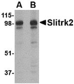 SLITRK2 Antibody in Western Blot (WB)