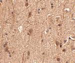 SLITRK3 Polyclonal Antibody