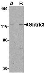 SLITRK3 Antibody in Western Blot (WB)