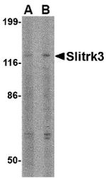 SLITRK3 Antibody in Western Blot (WB)