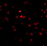 RIM3 Antibody in Immunohistochemistry (IHC)