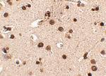 RIM3 Antibody in Immunohistochemistry (IHC)