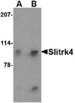 SLITRK4 Antibody in Western Blot (WB)