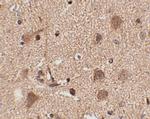 SLITRK5 Polyclonal Antibody
